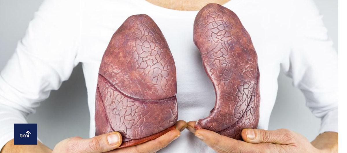 Lung Cancer Treatment