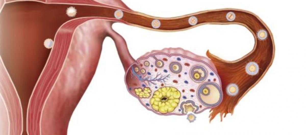 Effect on experimental medical treatment on Ovarian Cancer 