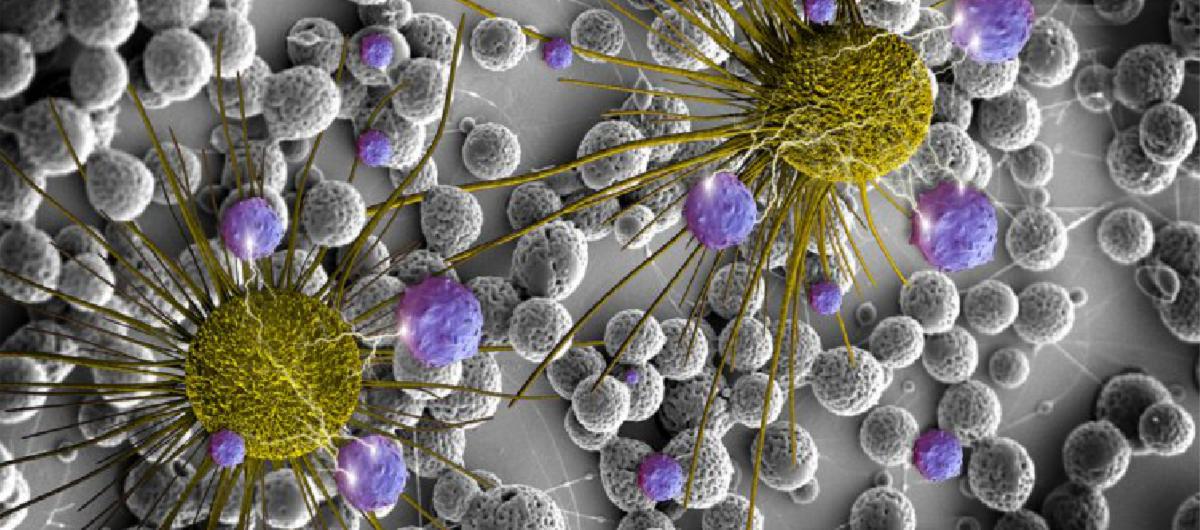 Molekulare Mechanismen der Anti-Krebs-Aktivität der natürlichen diätetischen Produkten MEGAMIN ACTIV