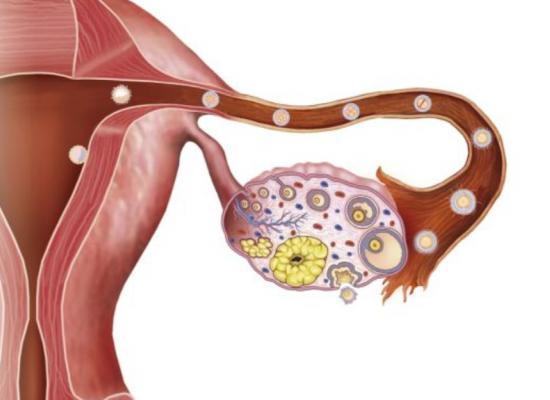 Effect on experimental medical treatment on Ovarian Cancer 