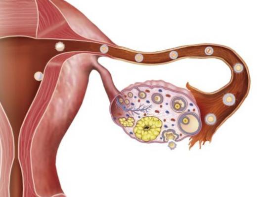 Effect on experimental medical treatment on Ovarian Cancer